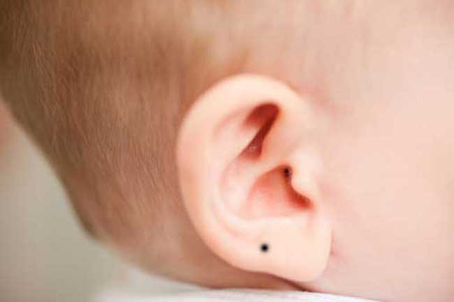ears-Meaning of moles