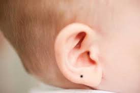 Mole on the ear