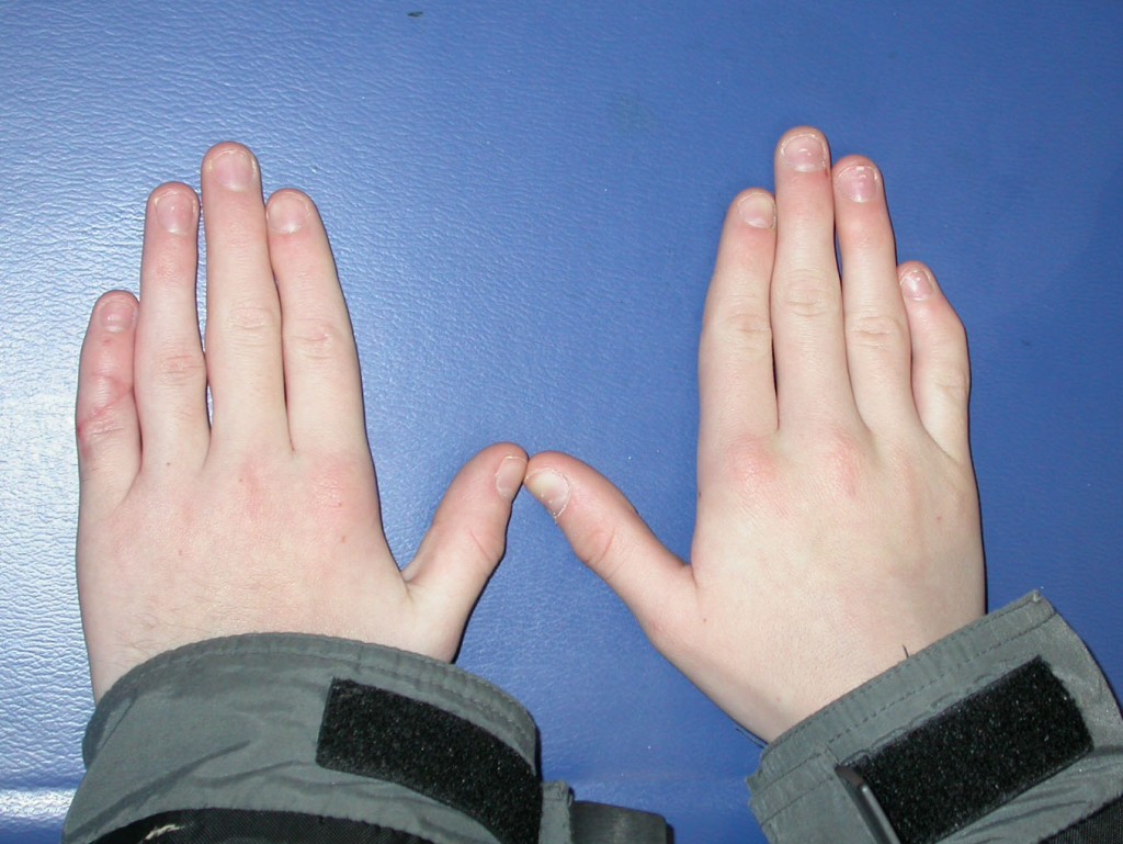 Curved Fingers Meaning 